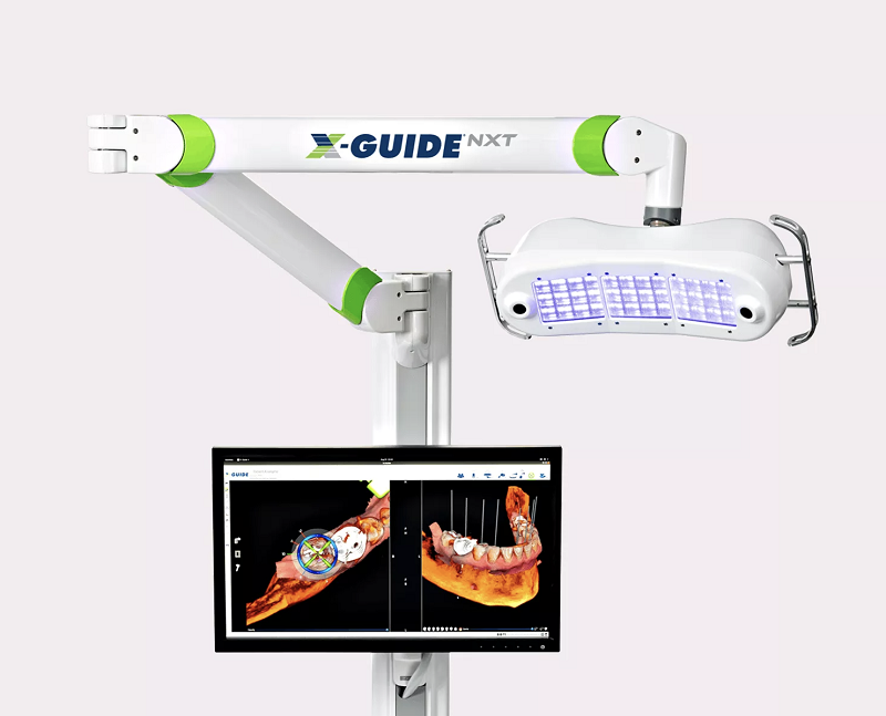 エックスガイド